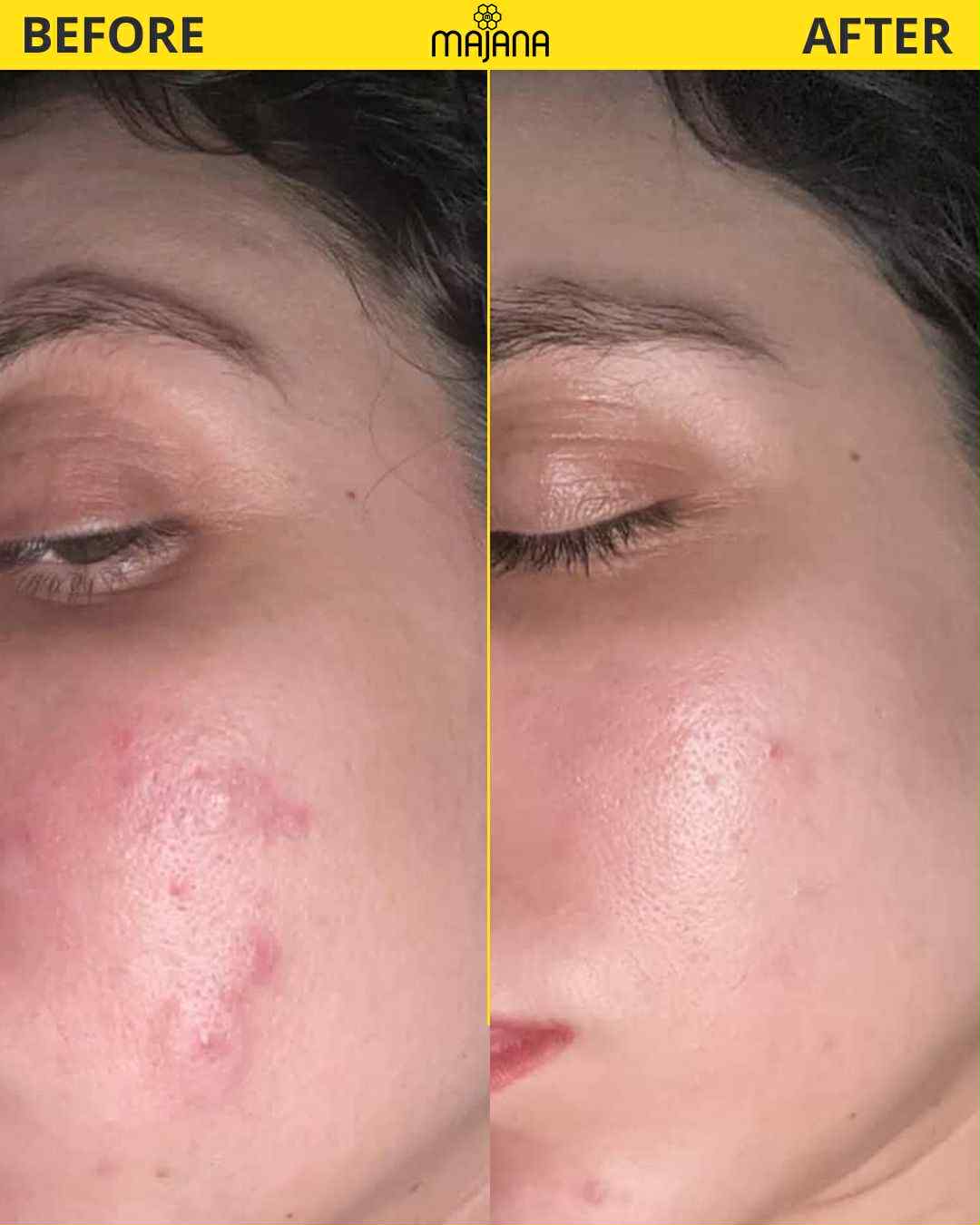 Niacin Hyaluron Correcting Serum