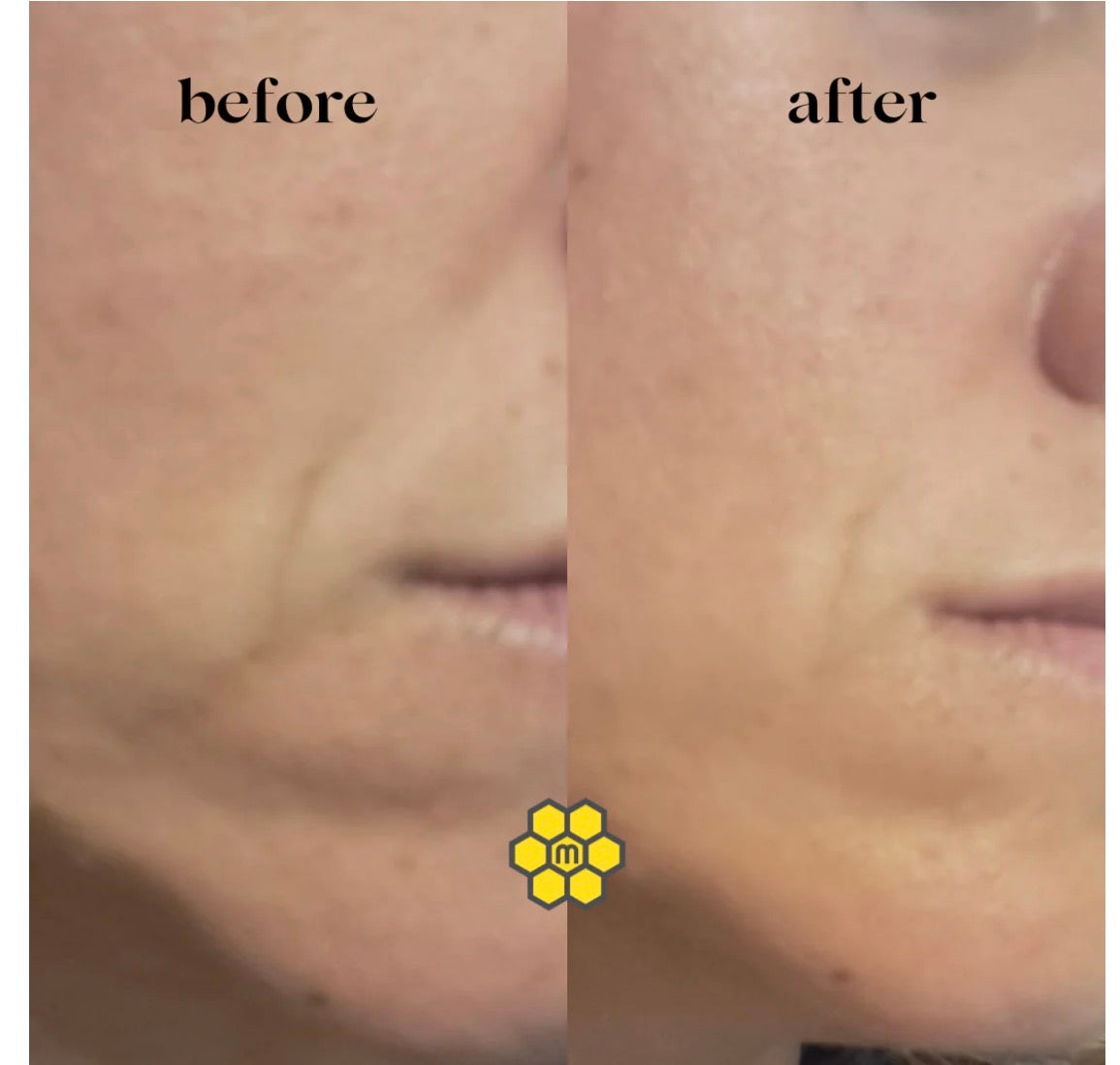 Propolis Oleoserum - Well-aging serum (239kr)